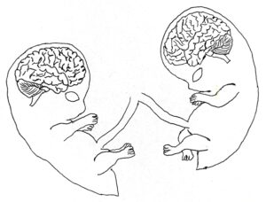 drawing of twins brains under development