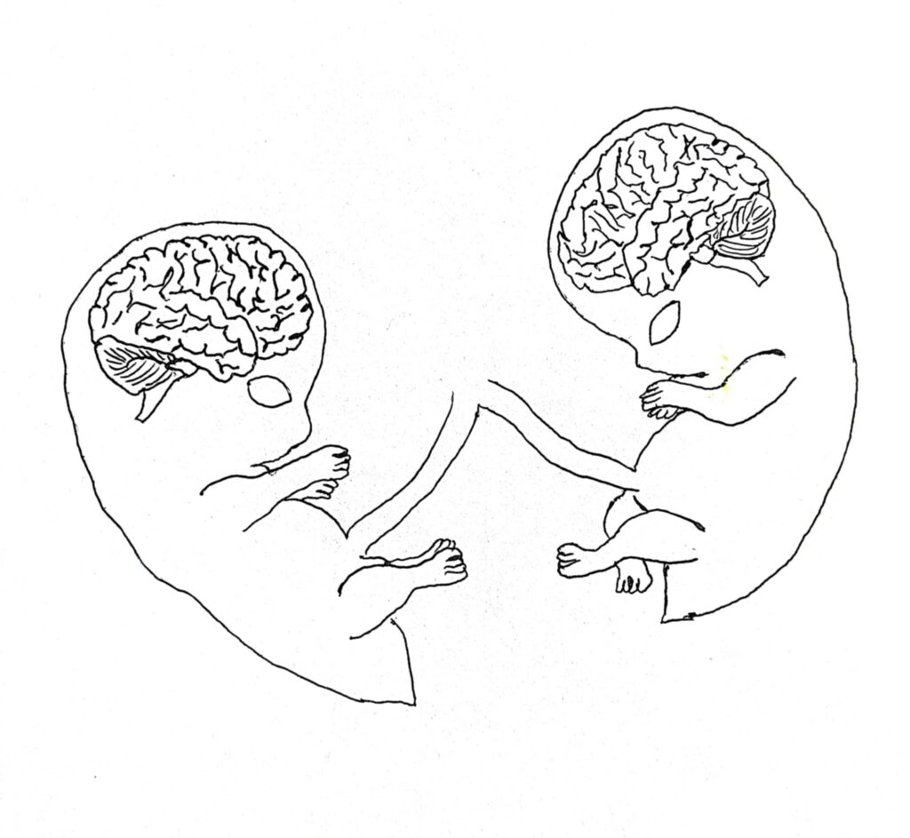drawing of twins brains under development